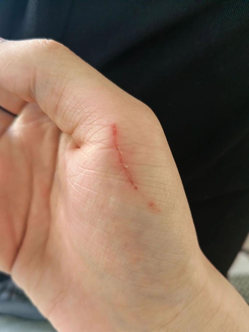 狗狗划破肠子症状表现,狗划破肠道有什么症状-第3张图片-后鲨宠物 狗狗划破肠子症状表现,狗划破肠道有什么症状-第3张图片-后鲨宠物