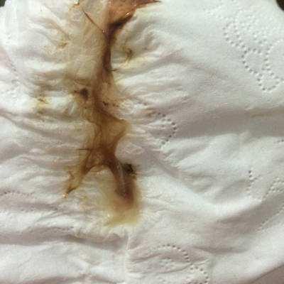 猫咪鼻子有分泌物,猫鼻孔分泌物-第3张图片-后鲨宠物 猫咪鼻子有分泌物,猫鼻孔分泌物-第3张图片-后鲨宠物