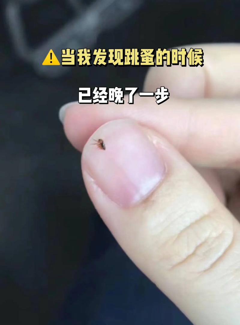 猫咪有虱子怎么去除,猫有猫虱子会怎样?-第2张图片-后鲨宠物 猫咪有虱子怎么去除,猫有猫虱子会怎样?-第2张图片-后鲨宠物