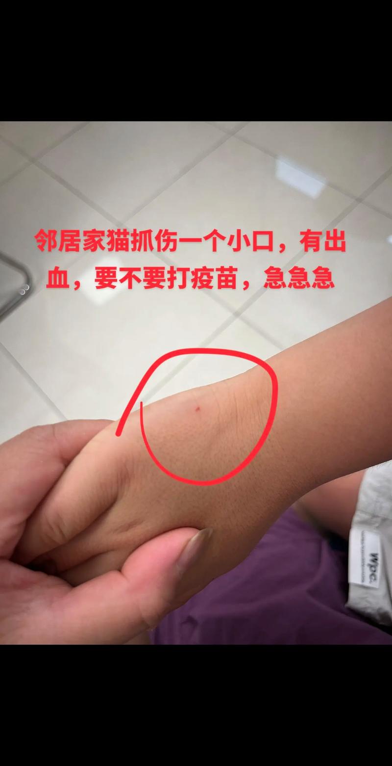 被猫咪抓了怎么办_被猫咪抓了怎么办时间比较长-第3张图片-后鲨宠物 被猫咪抓了怎么办_被猫咪抓了怎么办时间比较长-第3张图片-后鲨宠物