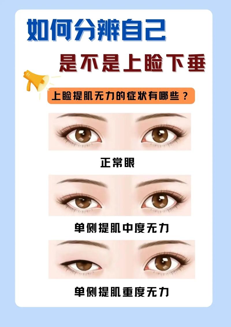 什么眼型是狗狗眼_什么眼型是狗狗眼型图片-第3张图片-后鲨宠物 什么眼型是狗狗眼_什么眼型是狗狗眼型图片-第3张图片-后鲨宠物