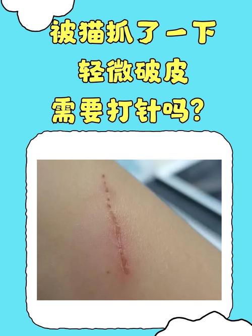 被猫咪抓了要打针吗,被猫咪抓了要打针吗要多少钱?-第5张图片-后鲨宠物 被猫咪抓了要打针吗,被猫咪抓了要打针吗要多少钱?-第5张图片-后鲨宠物