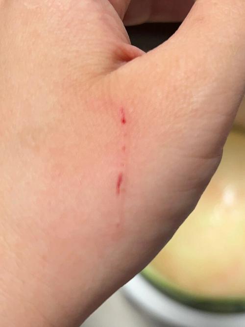 猫咪挠出血了怎么办,猫咪挠出血需要打疫苗吗-第4张图片-后鲨宠物 猫咪挠出血了怎么办,猫咪挠出血需要打疫苗吗-第4张图片-后鲨宠物