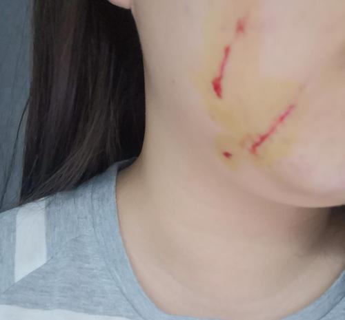 猫咪挠出血了怎么办,猫咪挠出血需要打疫苗吗-第6张图片-后鲨宠物 猫咪挠出血了怎么办,猫咪挠出血需要打疫苗吗-第6张图片-后鲨宠物