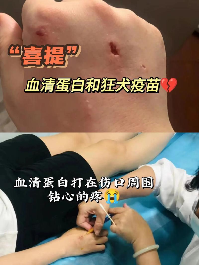 狗狗打血清有什么作用,狗狗打的血清是治啥的?-第3张图片-后鲨宠物 狗狗打血清有什么作用,狗狗打的血清是治啥的?-第3张图片-后鲨宠物