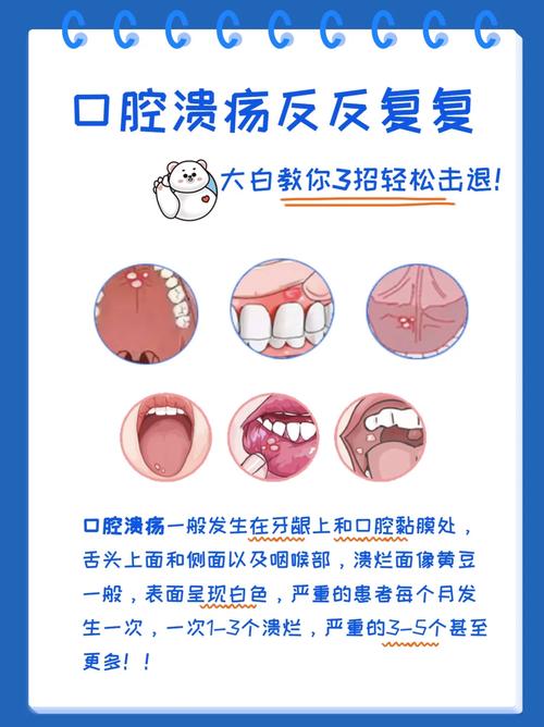 狗狗口腔溃疡的症状,狗狗口腔溃疡的症状有哪些?-第1张图片-后鲨宠物 狗狗口腔溃疡的症状,狗狗口腔溃疡的症状有哪些?-第1张图片-后鲨宠物