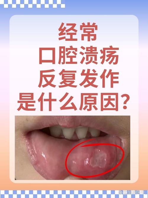 狗狗口腔溃疡的症状,狗狗口腔溃疡的症状有哪些?-第4张图片-后鲨宠物 狗狗口腔溃疡的症状,狗狗口腔溃疡的症状有哪些?-第4张图片-后鲨宠物
