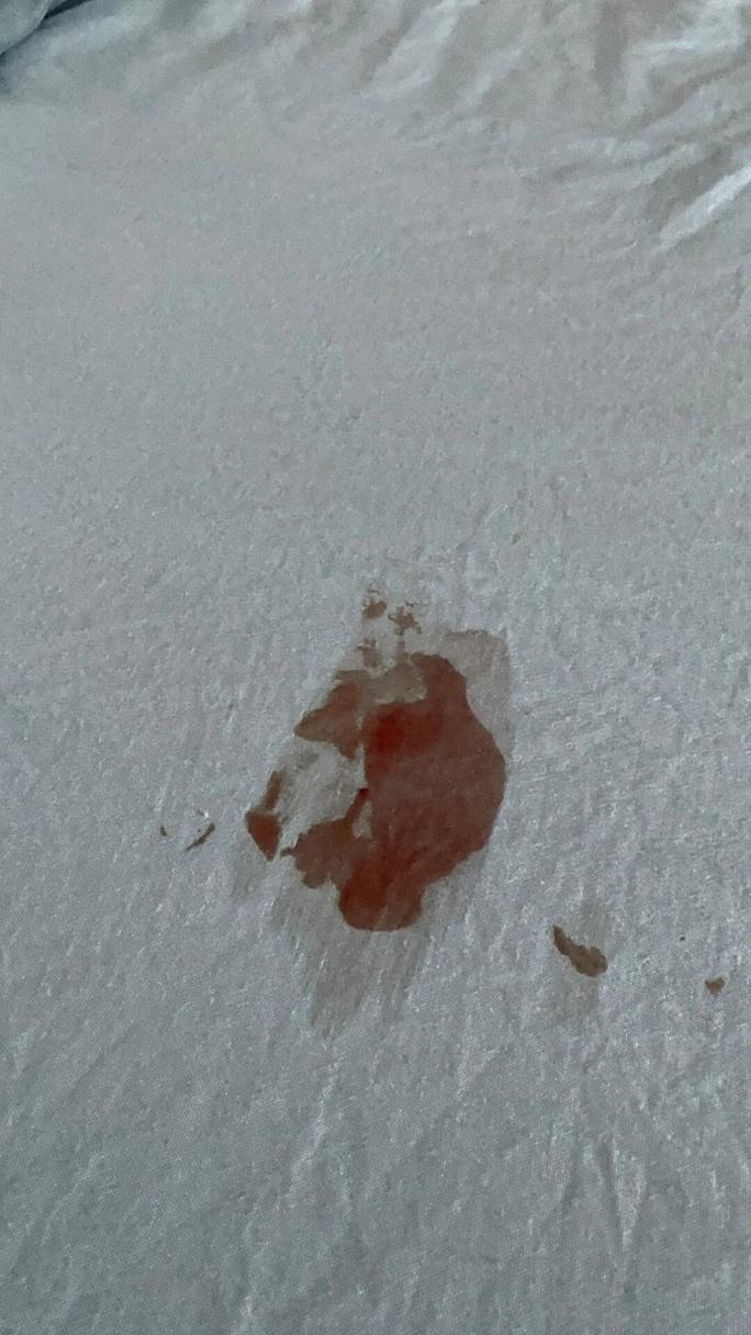 猫咪屁股有血怎么回事,猫咪屁股有血是怎么了-第1张图片-后鲨宠物 猫咪屁股有血怎么回事,猫咪屁股有血是怎么了-第1张图片-后鲨宠物