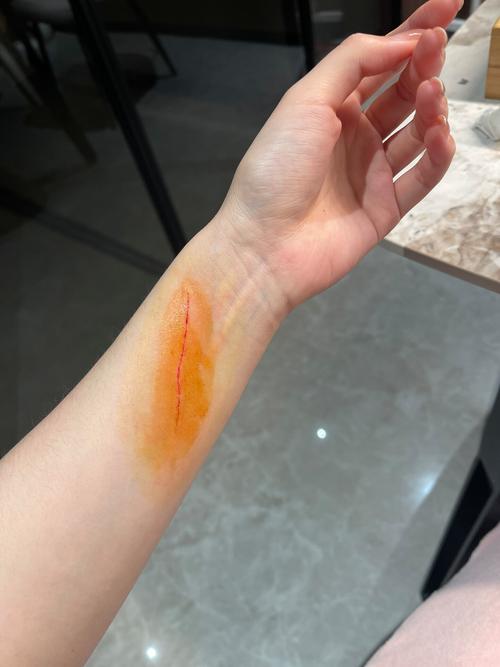 猫咪抓伤出血了怎么办_猫咪抓伤出血了怎么办不打疫苗-第2张图片-后鲨宠物 猫咪抓伤出血了怎么办_猫咪抓伤出血了怎么办不打疫苗-第2张图片-后鲨宠物