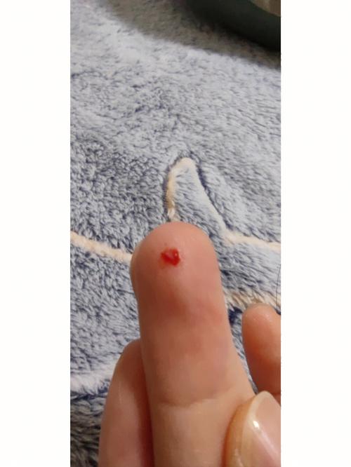 猫咪咬手怎么办,猫咪咬手怎么纠正?-第2张图片-后鲨宠物 猫咪咬手怎么办,猫咪咬手怎么纠正?-第2张图片-后鲨宠物