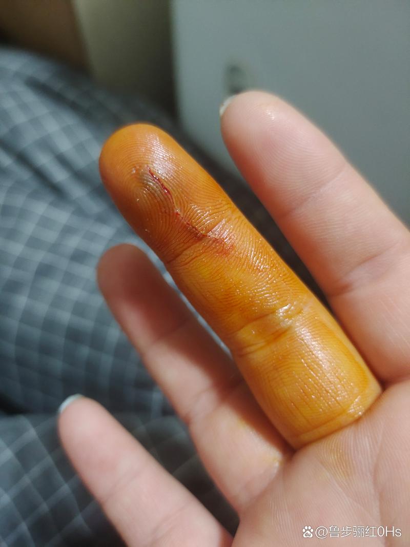 狗狗吃了肥皂会怎么样_狗不小心吃了肥皂会死吗-第2张图片-后鲨宠物 狗狗吃了肥皂会怎么样_狗不小心吃了肥皂会死吗-第2张图片-后鲨宠物