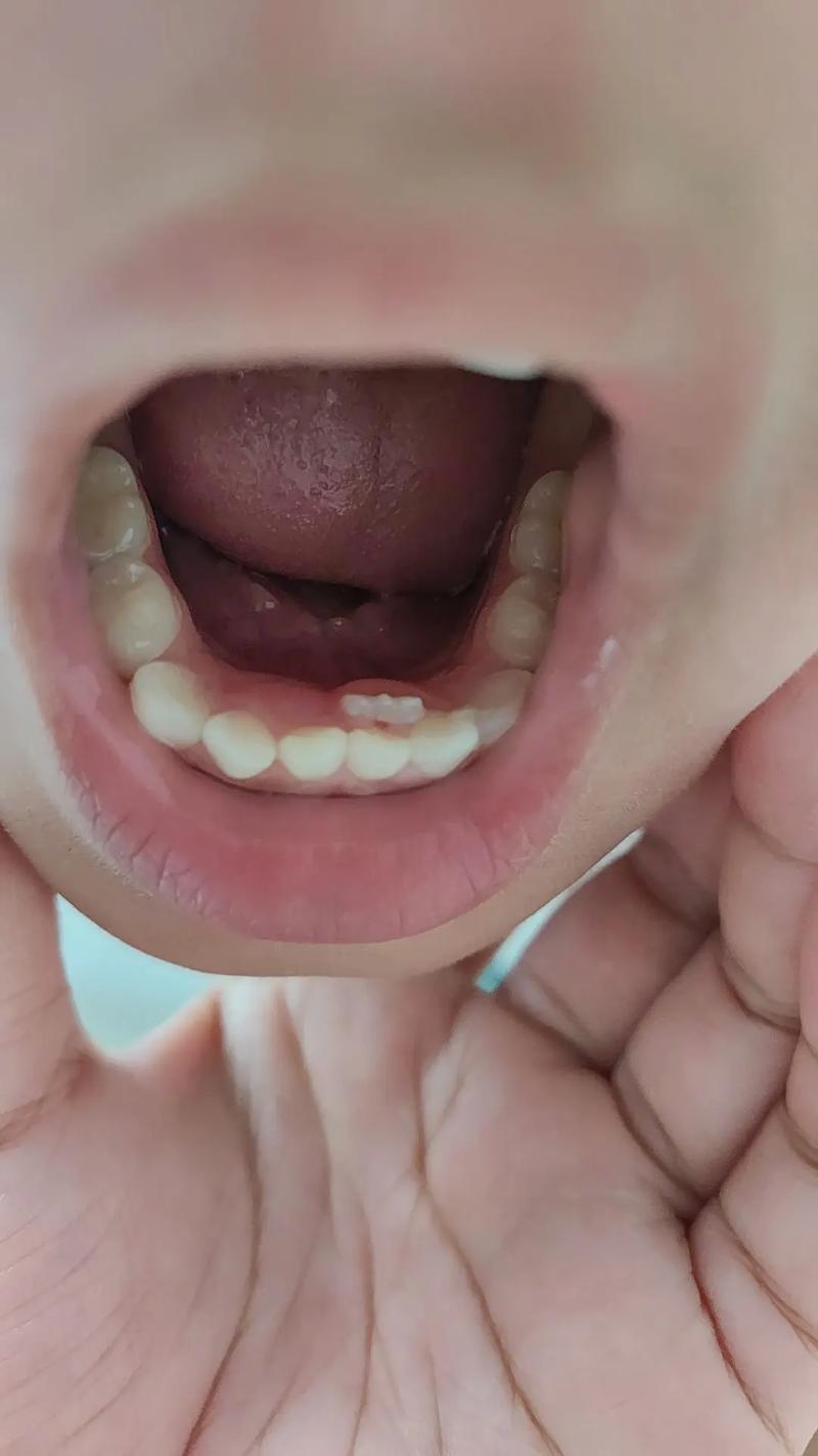 狗狗乳牙不掉怎么办,狗狗乳牙没掉恒牙长出怎么办-第6张图片-后鲨宠物 狗狗乳牙不掉怎么办,狗狗乳牙没掉恒牙长出怎么办-第6张图片-后鲨宠物