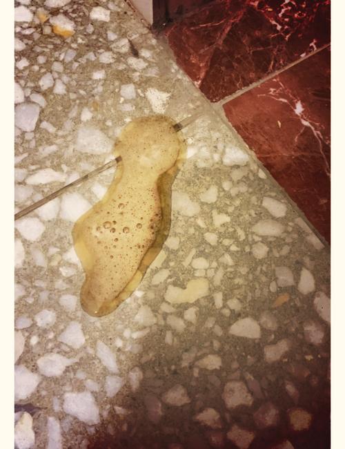 狗狗拉稀吐黄水怎么办_狗拉稀吐黄水还能喂吃的吗-第5张图片-后鲨宠物 狗狗拉稀吐黄水怎么办_狗拉稀吐黄水还能喂吃的吗-第5张图片-后鲨宠物