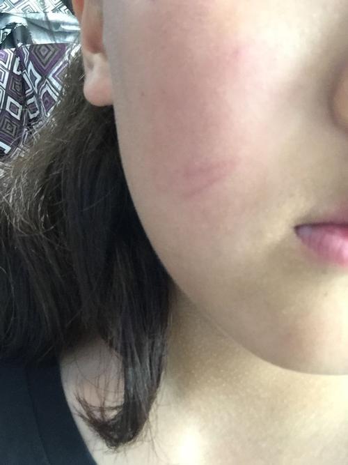 狗狗可以用碘酒消毒吗,狗能用碘伏的消毒水吗-第2张图片-后鲨宠物 狗狗可以用碘酒消毒吗,狗能用碘伏的消毒水吗-第2张图片-后鲨宠物