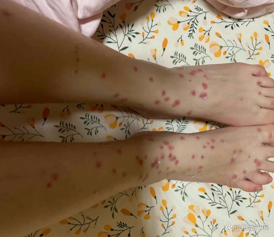 狗狗被跳蚤咬了怎么办,狗狗被跳蚤咬了怎么办图片?-第4张图片-后鲨宠物 狗狗被跳蚤咬了怎么办,狗狗被跳蚤咬了怎么办图片?-第4张图片-后鲨宠物