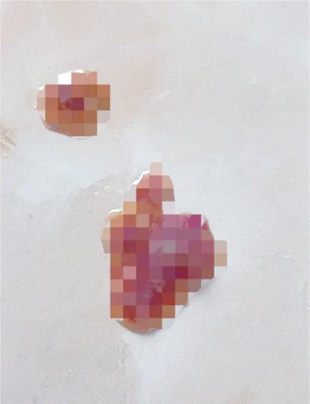 狗狗肠道划伤的症状_狗狗肠道划破的症状-第3张图片-后鲨宠物 狗狗肠道划伤的症状_狗狗肠道划破的症状-第3张图片-后鲨宠物