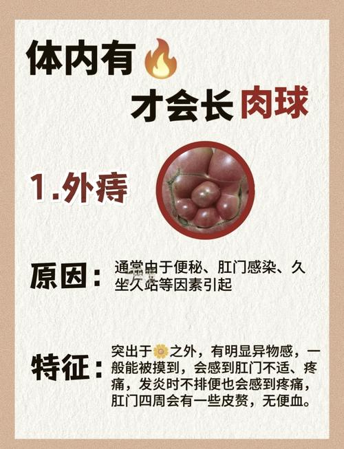 狗狗得痔疮怎么办,狗狗得痔疮怎么办吃什么药?-第5张图片-后鲨宠物 狗狗得痔疮怎么办,狗狗得痔疮怎么办吃什么药?-第5张图片-后鲨宠物