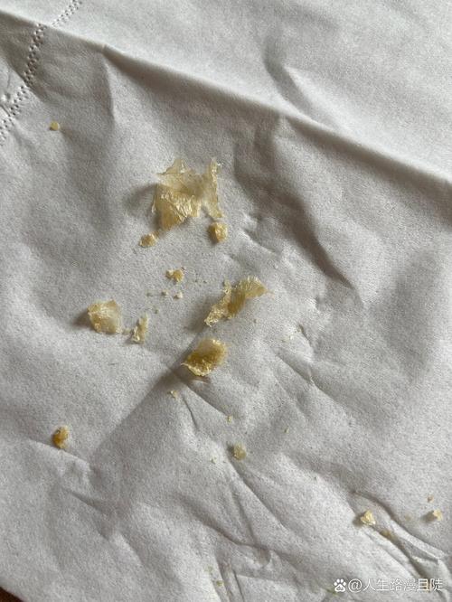 狗狗耳屎多怎么回事_狗耳屎又多又臭是怎么回事-第4张图片-后鲨宠物 狗狗耳屎多怎么回事_狗耳屎又多又臭是怎么回事-第4张图片-后鲨宠物