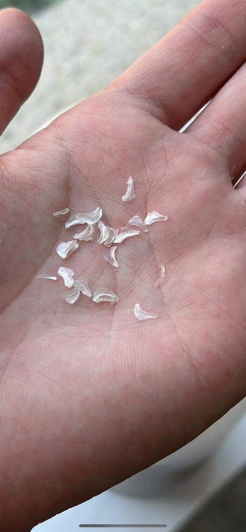 猫咪绦虫长什么样,猫的绦虫严重症状?-第5张图片-后鲨宠物 猫咪绦虫长什么样,猫的绦虫严重症状?-第5张图片-后鲨宠物