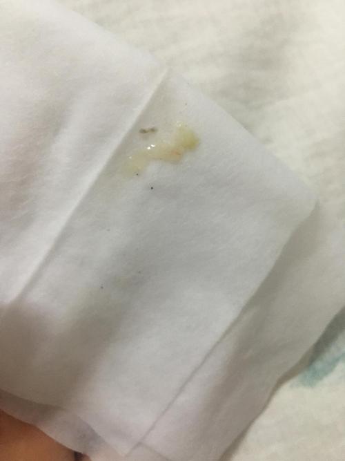 猫咪睡醒打喷嚏,猫咪睡醒打喷嚏喷出来水-第2张图片-后鲨宠物 猫咪睡醒打喷嚏,猫咪睡醒打喷嚏喷出来水-第2张图片-后鲨宠物