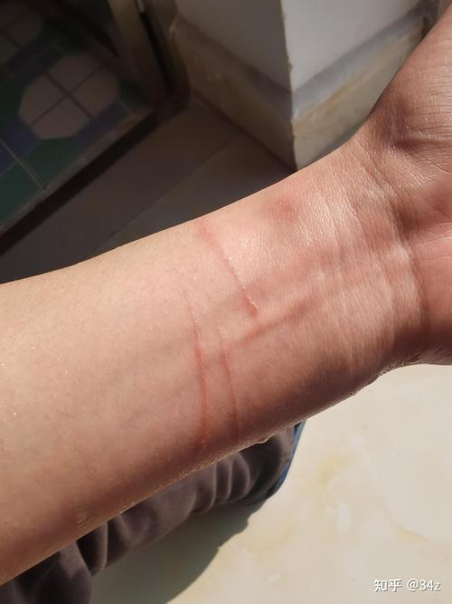 猫咪抓伤出血要打针吗,猫咪抓了出血了怎么办-第1张图片-后鲨宠物 猫咪抓伤出血要打针吗,猫咪抓了出血了怎么办-第1张图片-后鲨宠物