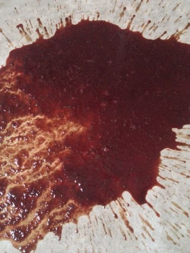 狗狗腹水怎么引起的,狗狗腹水可能是由于什么病引起的-第5张图片-后鲨宠物 狗狗腹水怎么引起的,狗狗腹水可能是由于什么病引起的-第5张图片-后鲨宠物