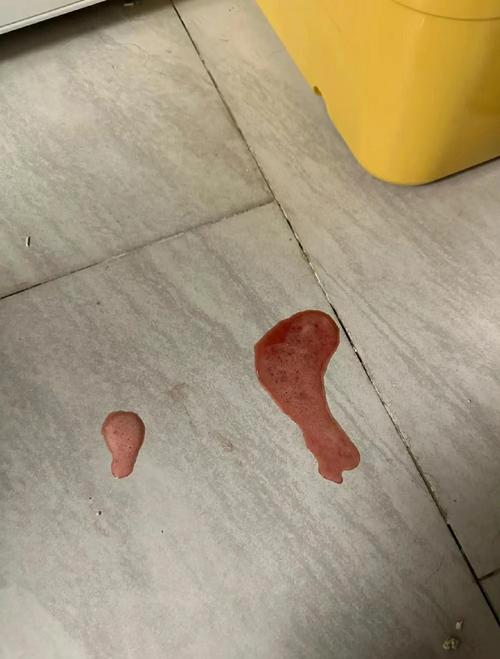 猫咪内出血有什么症状,猫咪内出血有什么症状表现?-第3张图片-后鲨宠物 猫咪内出血有什么症状,猫咪内出血有什么症状表现?-第3张图片-后鲨宠物