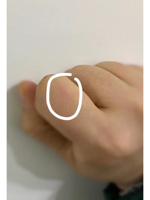 被猫咪抓了没出血,被猫咪抓了没出血会有事吗?-第3张图片-后鲨宠物 被猫咪抓了没出血,被猫咪抓了没出血会有事吗?-第3张图片-后鲨宠物