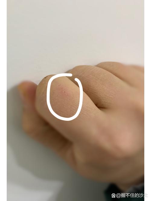 被猫咪抓了没出血,被猫咪抓了没出血会有事吗?-第5张图片-后鲨宠物 被猫咪抓了没出血,被猫咪抓了没出血会有事吗?-第5张图片-后鲨宠物