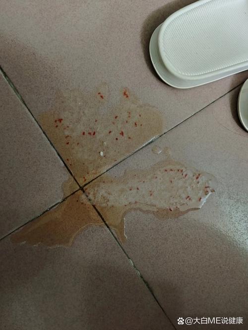 猫咪呕吐带血丝,猫咪呕吐带血丝怎么回事-第5张图片-后鲨宠物 猫咪呕吐带血丝,猫咪呕吐带血丝怎么回事-第5张图片-后鲨宠物