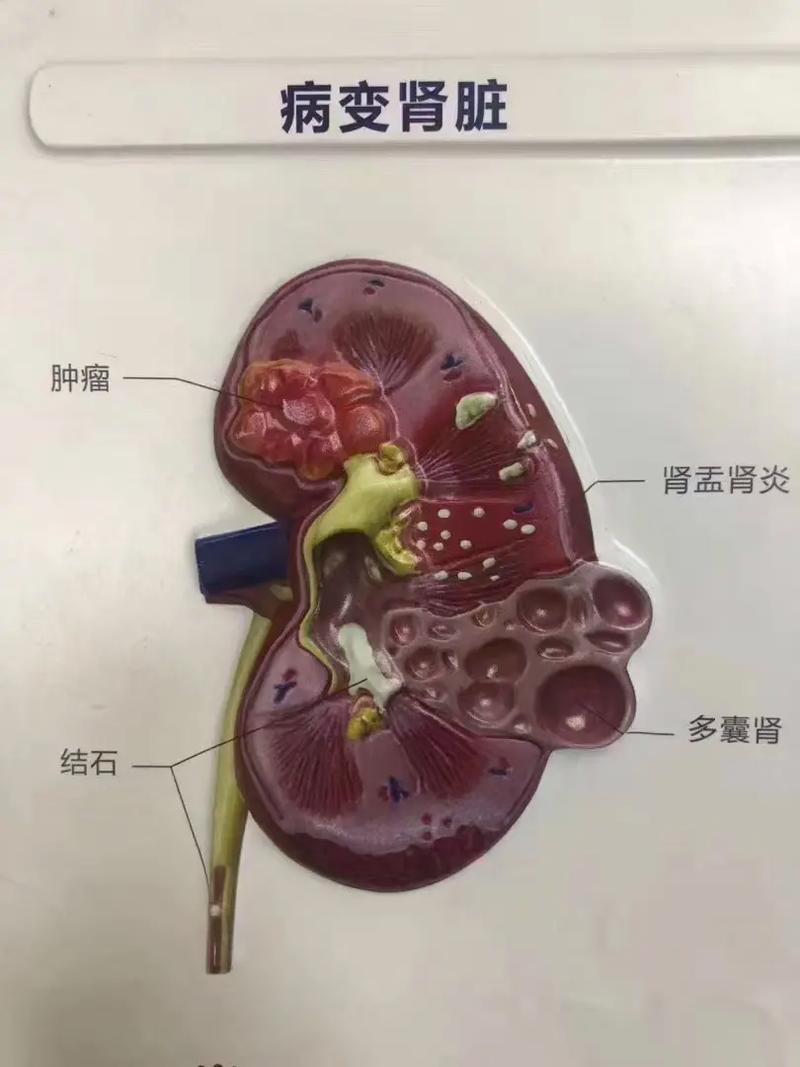  猫咪多囊肾可以活多久，猫咪多囊肾有奇迹吗-第2张图片-后鲨宠物