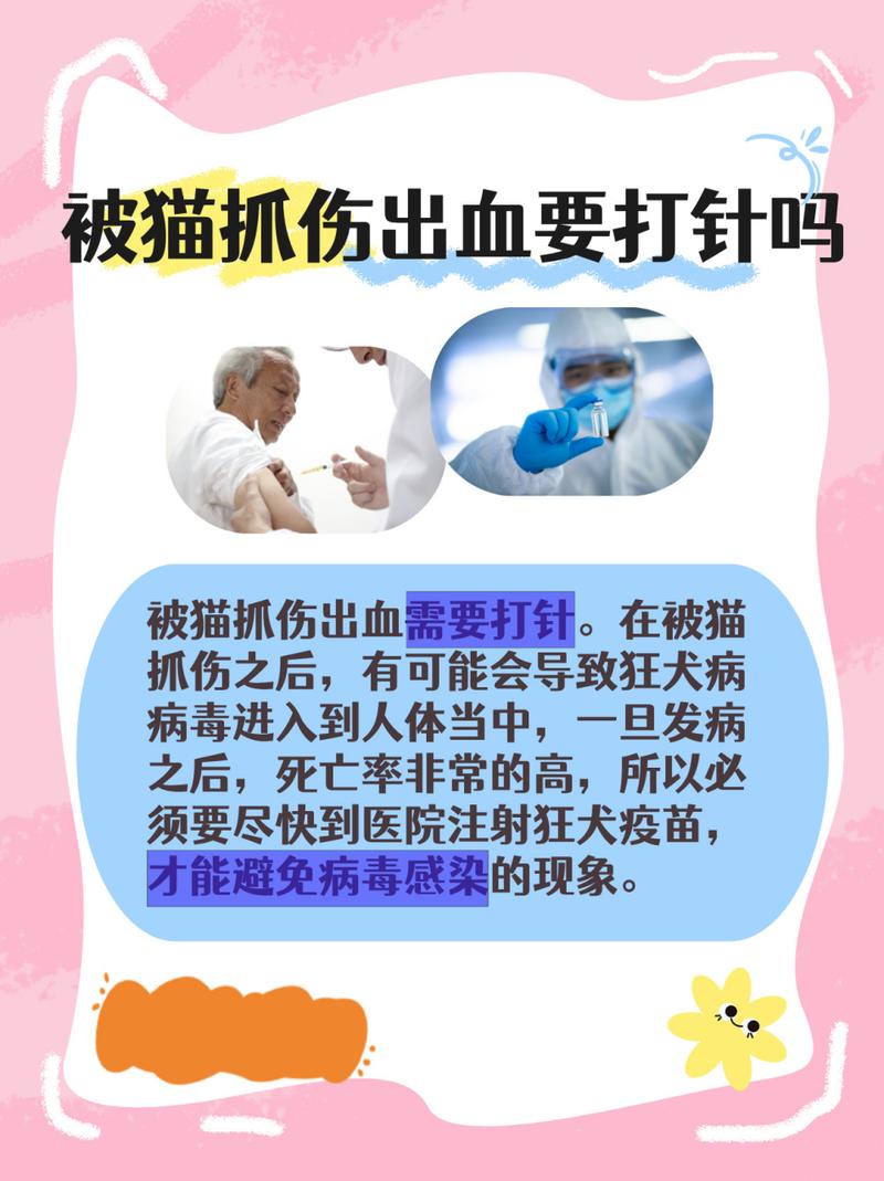 被猫猫抓伤了需要打针吗,被猫抓伤用不用打针?-第2张图片-后鲨宠物 被猫猫抓伤了需要打针吗,被猫抓伤用不用打针?-第2张图片-后鲨宠物