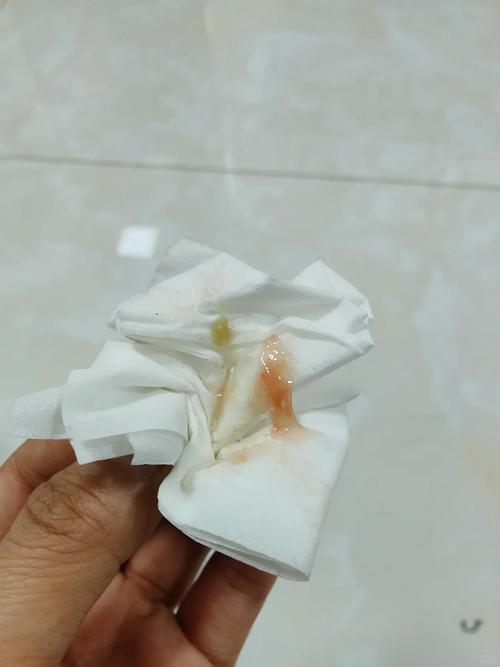 猫咪打喷嚏有血,猫打喷嚏甩出浓稠鼻涕带血?-第4张图片-后鲨宠物 猫咪打喷嚏有血,猫打喷嚏甩出浓稠鼻涕带血?-第4张图片-后鲨宠物