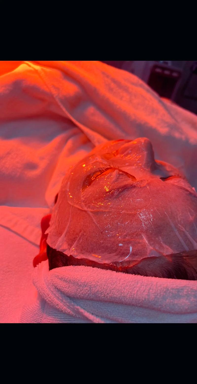  猫咪脖子上有疙瘩，猫咪脖子上有疙瘩,痒-第3张图片-后鲨宠物