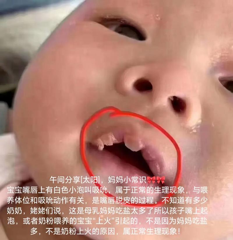 猫咪下嘴唇长了红点小泡,猫咪下嘴唇长了红点小泡泡怎么办-第2张图片-后鲨宠物 猫咪下嘴唇长了红点小泡,猫咪下嘴唇长了红点小泡泡怎么办-第2张图片-后鲨宠物