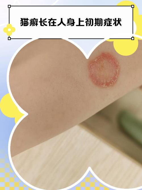 猫咪下嘴唇长了红点小泡,猫咪下嘴唇长了红点小泡泡怎么办-第3张图片-后鲨宠物 猫咪下嘴唇长了红点小泡,猫咪下嘴唇长了红点小泡泡怎么办-第3张图片-后鲨宠物