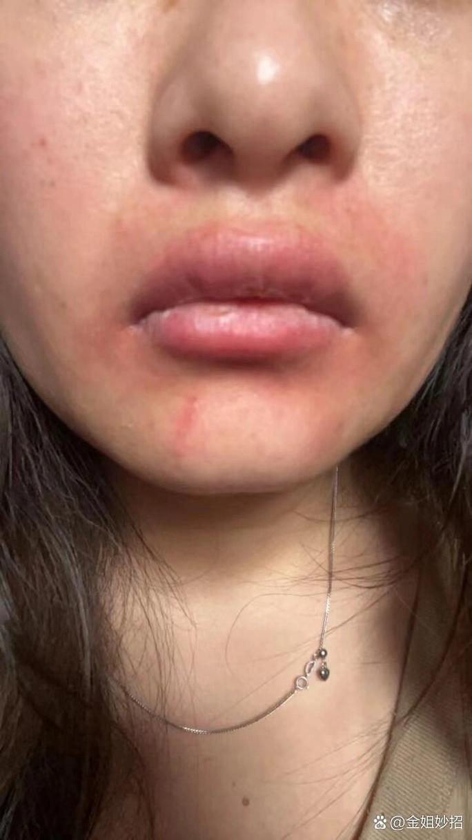 猫咪下嘴唇长了红点小泡,猫咪下嘴唇长了红点小泡泡怎么办-第5张图片-后鲨宠物 猫咪下嘴唇长了红点小泡,猫咪下嘴唇长了红点小泡泡怎么办-第5张图片-后鲨宠物